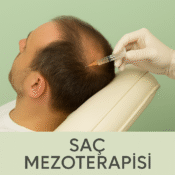 Saç Mezoterapisi